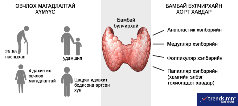 БАМБАЙ БУЛЧИРХАЙН ХОРТ ХАВДАР | trends.mn